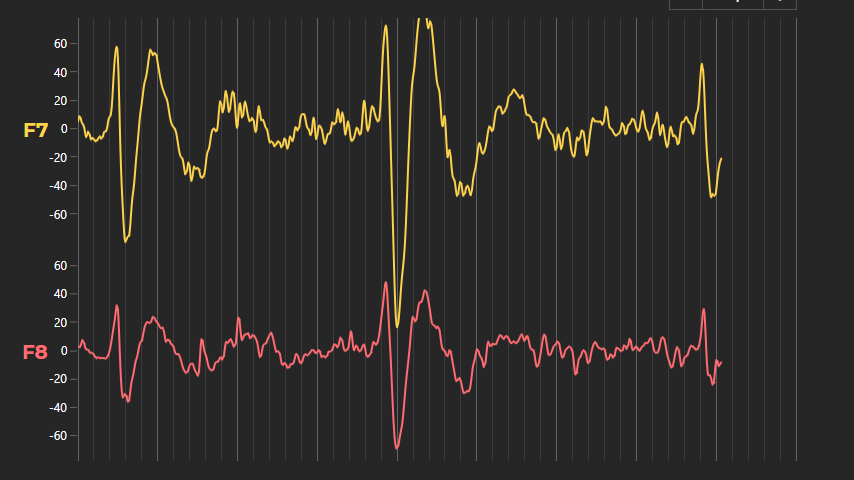 Screenshot of WPF Chart